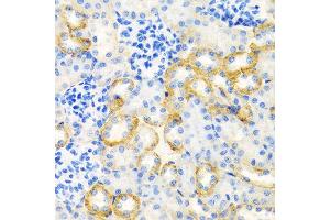 Immunohistochemistry of paraffin-embedded rat kidney using STC1 antibody at dilution of 1:100 (40x lens). (Stanniocalcin 1 anticorps)