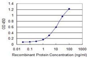 Detection limit for recombinant GST tagged RNF133 is 0.