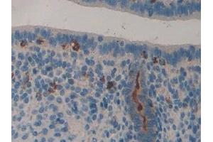 Detection of LCN8 in Mouse Uterus Tissue using Polyclonal Antibody to Lipocalin 8 (LCN8)