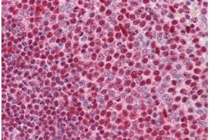 Human Spleen: Formalin-Fixed, Paraffin-Embedded (FFPE)