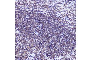Immunohistochemistry of paraffin-embedded mouse spleen using USP39 Rabbit mAb (ABIN7271160) at dilution of 1:100 (40x lens).