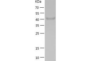 Western Blotting (WB) image for LanC Lantibiotic Synthetase Component C-Like 1 (LANCL1) (AA 1-399) protein (His-IF2DI Tag) (ABIN7123716)