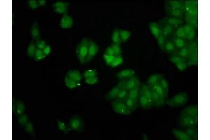 Immunofluorescence staining of HepG2 cells with ABIN7162855 at 1:266, counter-stained with DAPI.