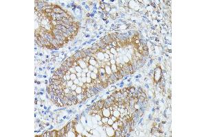 Immunohistochemistry of paraffin-embedded human appendix using PNLIPRP1 antibody (ABIN7269167) at dilution of 1:100 (40x lens).