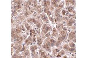 Immunohistochemistry of TREX2 in human liver tissue with this product at 2. (TREX2 anticorps  (C-Term))