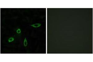 Immunofluorescence analysis of LOVO cells, using EDG4 Antibody.