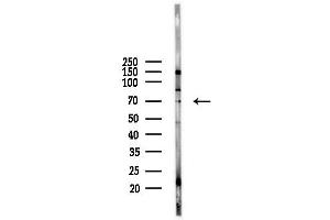 Western blot analysis of lysates from  cells(starvation,24h treatment), using M Antibody at 1/1000 dilution. (MTA3 anticorps  (Internal Region))