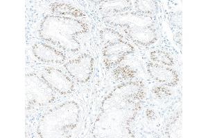 Immunohistochemistry (IHC) image for anti-Kruppel-Like Factor 4 (Gut) (KLF4) (AA 75-125) antibody (ABIN7795639) (Recombinant KLF4 anticorps  (AA 75-125))