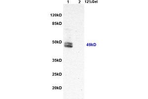 Lane 1: rat liver lysates Lane 2: rat brain lysates probed with Anti Hepatitis C Virus NS5a Polyclonal Antibody, Unconjugated (ABIN1385124) at 1:200 in 4 °C. (HCV NS5a anticorps)