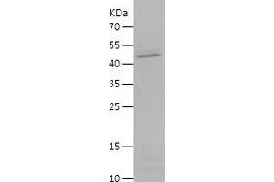 Western Blotting (WB) image for Deoxyribonuclease I (DNASE1) (AA 23-282) protein (His-IF2DI Tag) (ABIN7122635) (DNASE1 Protein (AA 23-282) (His-IF2DI Tag))
