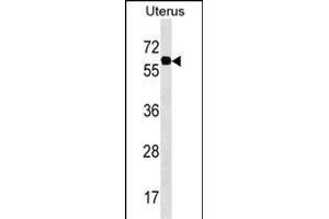 PGM3 Antibody (Center) (ABIN1538149 and ABIN2850274) western blot analysis in Uterus tissue lysates (35 μg/lane). (Phosphoglucomutase 3 anticorps  (AA 237-263))