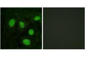 Immunofluorescence analysis of HeLa cells, using Histone H1 (Ab-25) Antibody. (Histone H1 anticorps  (AA 131-180))