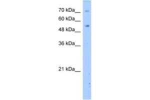 Western Blotting (WB) image for anti-Dihydropyrimidinase (DPYS) antibody (ABIN2462414)