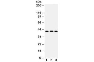 Western blot testing of 1) human U87, 2) human HepG2 and 3) mouse brain lysate with HLA-A antibody.