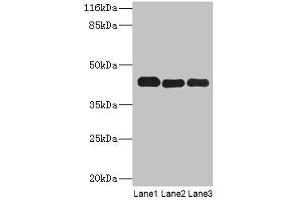Western blot All lanes: PPME1 antibody at 2 μg/mL Lane 1: A549 whole cell lysate Lane 2: Hela whole cell lysate Lane 3: Mouse brain tissue Secondary Goat polyclonal to rabbit IgG at 1/10000 dilution Predicted band size: 43, 23, 19, 44 kDa Observed band size: 43 kDa (PPME1 anticorps  (AA 201-386))
