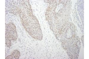Immunohistochemistry (IHC) image for anti-DEAD (Asp-Glu-Ala-Asp) Box Polypeptide 21 (DDX21) (C-Term) antibody (ABIN7448516) (DDX21 anticorps  (C-Term))