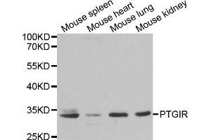 Western blot analysis of extracts of various cell lines, using PTGIR antibody.