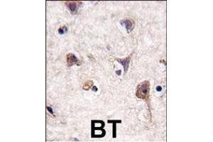 Formalin-fixed and paraffin-embedded human brain tissue reacted with Autophagy LC3 Antibody (G8a) (N-term), which was peroxidase-conjugated to the secondary antibody, followed by DAB staining. (MAP1LC3A anticorps  (N-Term))