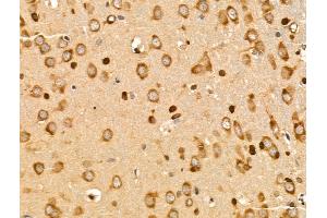ABIN7094837 and ABIN7098888 at 1/100 staining Rat brain tissue by IHC-P. (SUCLG1 anticorps  (N-Term))