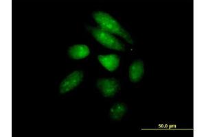 Immunofluorescence of purified MaxPab antibody to PER1 on HeLa cell. (PER1 anticorps  (AA 1-1290))