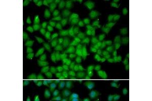 Immunofluorescence analysis of HeLa cells using CDKN2C Polyclonal Antibody