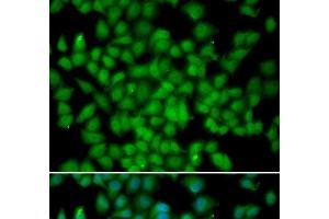 Immunofluorescence analysis of HeLa cells using CDKN2C Polyclonal Antibody (CDKN2C anticorps)