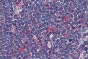 Immunohistochemistry staining of human thymus (paraffin sections) using anti-Cdk1 (clone POH-1).