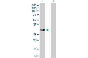 Western Blot analysis of CDK2 expression in transfected 293T cell line by CDK2 monoclonal antibody (M02), clone 2E8.