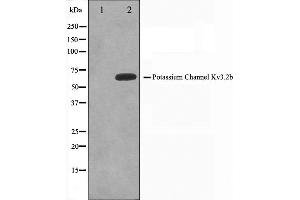 Western blot analysis on HepG2 cell lysate using KCNC2 Antibody,The lane on the left is treated with the antigen-specific peptide. (KCNC2 anticorps  (C-Term))