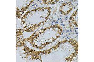 Immunohistochemistry of paraffin-embedded human stomach using SIGMAR1 antibody (ABIN5973191) (40x lens). (SIGMAR1 anticorps)