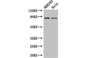 Western Blot Positive WB detected in: HEK293 whole cell lysate, Hela whole cell lysate All lanes: MLH1 antibody at 3 μg/mL Secondary Goat polyclonal to rabbit IgG at 1/50000 dilution Predicted band size: 85, 59, 74 kDa Observed band size: 85 kDa (MLH1 anticorps  (AA 350-519))