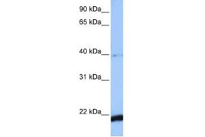 WB Suggested Anti-HBS1L Antibody Titration: 0. (HBS1L anticorps  (C-Term))