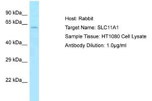Host: Rabbit Target Name: SLC11A1 Sample Type: HT1080 Whole Cell lysates Antibody Dilution: 1. (SLC11A1 anticorps  (Middle Region))