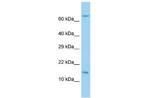 Host: Rabbit Target Name: RPL36AL Sample Type: Hela Whole Cell lysates Antibody Dilution: 1. (RPL36AL anticorps  (C-Term))