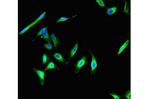 Immunofluorescent analysis of Hela cells using ABIN7146292 at dilution of 1:100 and Alexa Fluor 488-congugated AffiniPure Goat Anti-Rabbit IgG(H+L) (CIB2 anticorps  (AA 65-164))