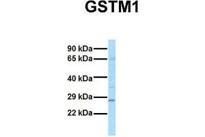 Host:  Rabbit  Target Name:  GSTM1  Sample Tissue:  Human Fetal Lung  Antibody Dilution:  1. (GSTM1 anticorps  (N-Term))