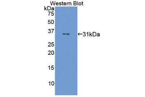 Western Blotting (WB) image for anti-Coagulation Factor XIII, A1 Polypeptide (F13A1) (AA 140-377) antibody (ABIN1867819) (F13A1 anticorps  (AA 140-377))