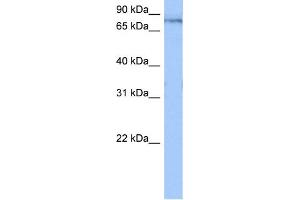 WB Suggested Anti-TTC14 Antibody Titration:  0.