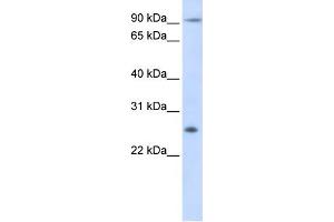 WB Suggested Anti-TSPAN31 Antibody Titration:  0. (TSPAN31 anticorps  (Middle Region))