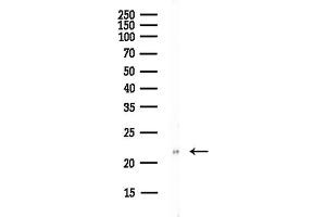 Western blot analysis of lysates from PC12 cells(starvation,24h treatment), using PSM Antibody at 1/1000 dilution.