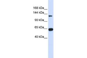 WB Suggested Anti-RGS22 Antibody Titration: 0. (RGS22 anticorps  (N-Term))