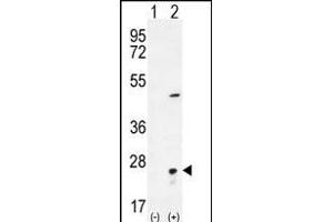 Western blot analysis of VSNL1 (arrow) using rabbit polyclonal VSNL1 Antibody (Center) (ABIN656135 and ABIN2845474). (VSNL1 anticorps  (AA 47-75))