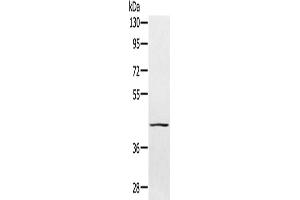 Gel: 8 % SDS-PAGE, Lysate: 40 μg, Lane: 231 cells, Primary antibody: ABIN7130778(PTPN7 Antibody) at dilution 1/300, Secondary antibody: Goat anti rabbit IgG at 1/8000 dilution, Exposure time: 1 minute (PTPN7 anticorps)