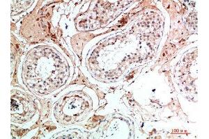 anti-Nanos Homolog 1 (NANOS1) (AA 151-200) antibody