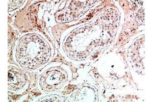 Immunohistochemical analysis of paraffin-embedded human-testis, antibody was diluted at 1:200 (Nanos Homolog 1 anticorps  (AA 151-200))