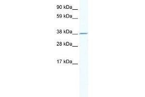 Human Thymus; WB Suggested Anti-RNF130 Antibody Titration: 2. (RNF130 anticorps  (N-Term))