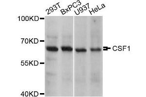 Western blot analysis of extracts of various cell lines, using CSF1 antibody. (M-CSF/CSF1 anticorps)