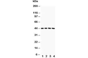 Western blot testing of SIRT3 antibody and Lane 1:  rat spleen;  2: human placenta;  3: HeLa;  4: COLO320 (SIRT3 anticorps  (AA 66-399))