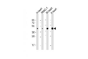 All lanes : Anti-WNT5A Antibody (Center) at 1:2000 dilution Lane 1: human heart lysate Lane 2: NC-1 whole cell lysate Lane 3: mouse heart lysate Lane 4: rat heart lysate Lysates/proteins at 20 μg per lane. (WNT5A anticorps  (AA 185-213))