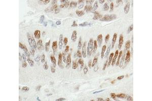 Immunohistochemistry (IHC) image for anti-Zinc Finger and BTB Domain Containing 7A (ZBTB7A) (C-Term) antibody (ABIN7453870)
